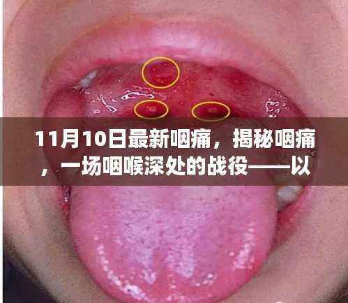 揭秘咽痛,咽喉深处的战役——最新日期下的背景、事件、影响与时代地位