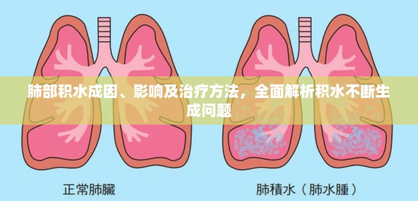 肺部积水成因、影响及治疗方法,全面解析积水不断生成问题