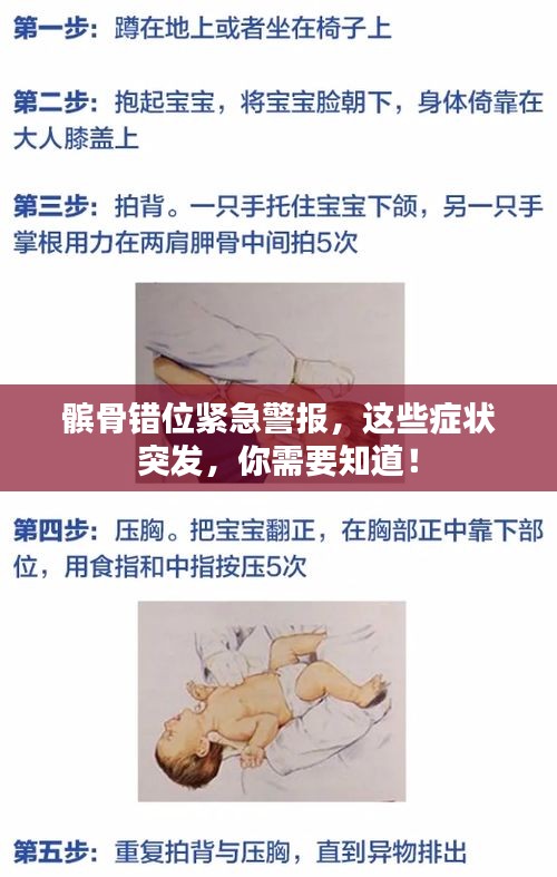 髌骨错位紧急警报，这些症状突发，你需要知道！